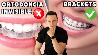 La ortodoncia invisible NO ES PARA TODOS  Brackets vs Invisalign [upl. by Asseneg]