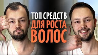 ТОП 5 средств для роста волос от врача дерматолога [upl. by Bena]