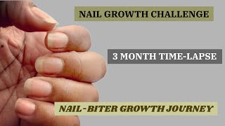 NAIL BITER GROWTH JOURNEY  Nail Growth Time Lapse  I Quit Nail Biting [upl. by Assirim663]