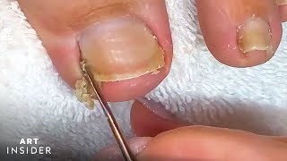 How Toenails Are Professionally Cleaned [upl. by Christalle]