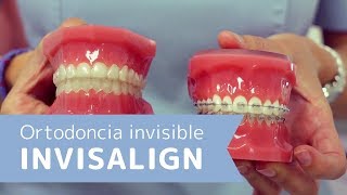 ¿Cómo funciona la ortodoncia invisible o Invisalign Resolvemos tus dudas de este tratamiento dental [upl. by Noslen]