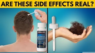 REAL TRUTH About Minoxidil Side Effects [upl. by Nomad]