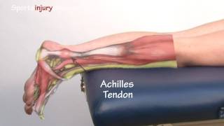 Achilles Tendonitis  Tendinopathy  Explained in 90 Seconds [upl. by Der]