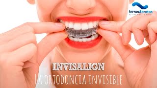 Invisalign la ortodoncia sin brackets [upl. by Ewer]